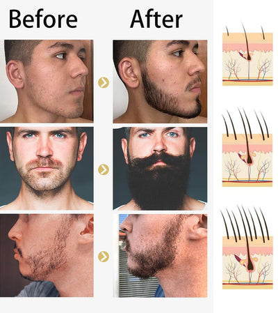 Beard Growth Kit