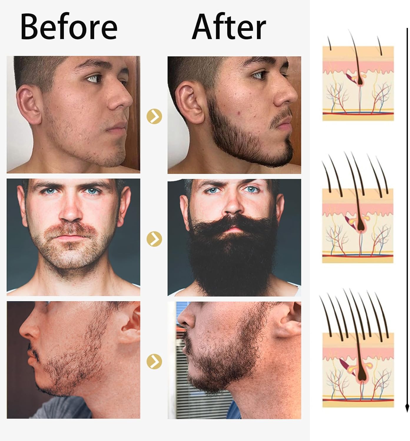 Beard Growth Kit