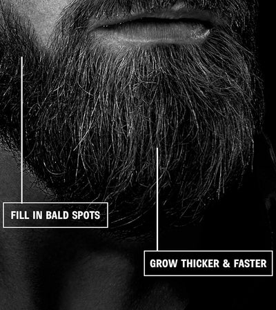 Beard Growth Kit