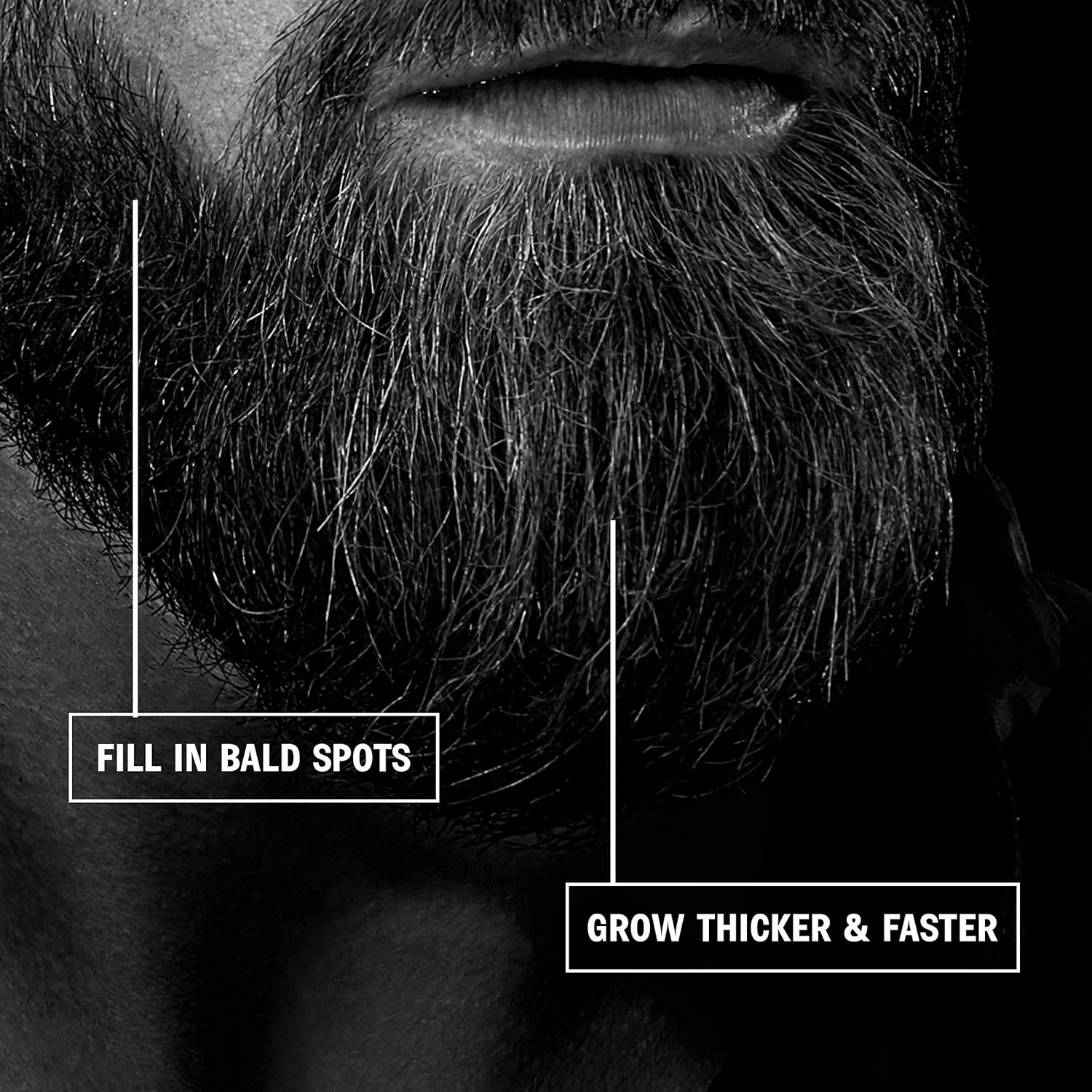 Beard Growth Kit