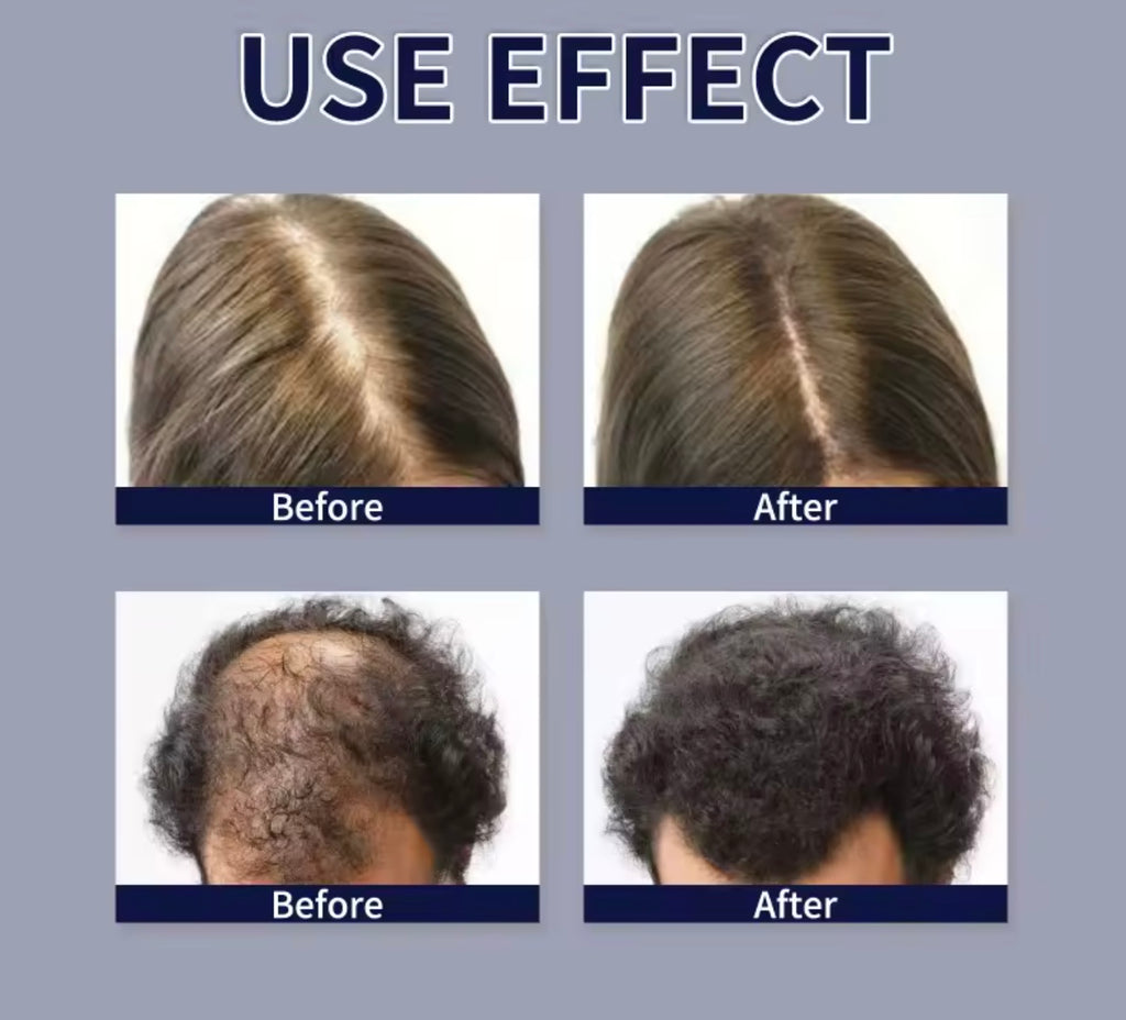 Before and after hair treatment comparisons on a gray background