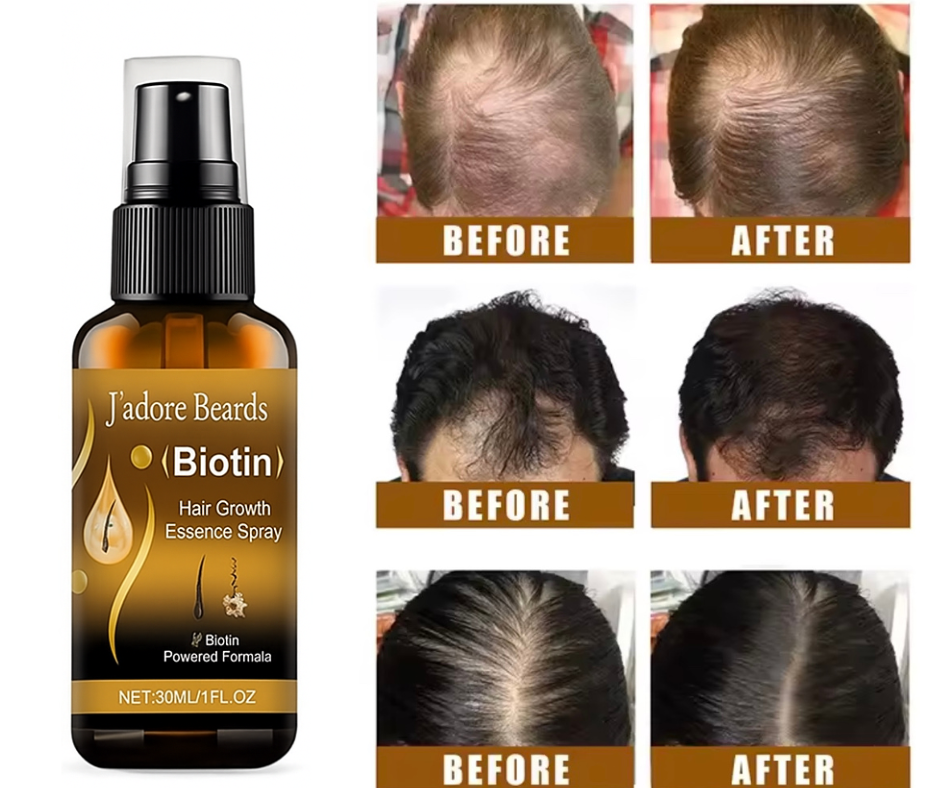 Hair growth spray bottle with 'J'adore Beards' branding and before-and-after hair growth results.